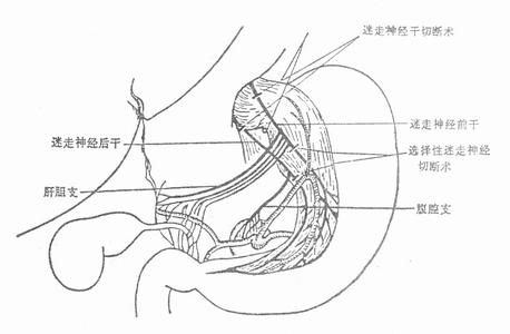 金华清宫手术那里好