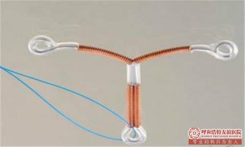 上环的副作用有哪些