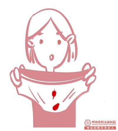 女性白带增多的原因有哪些