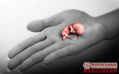 药流后用不用卧床休息 不看会后悔的
